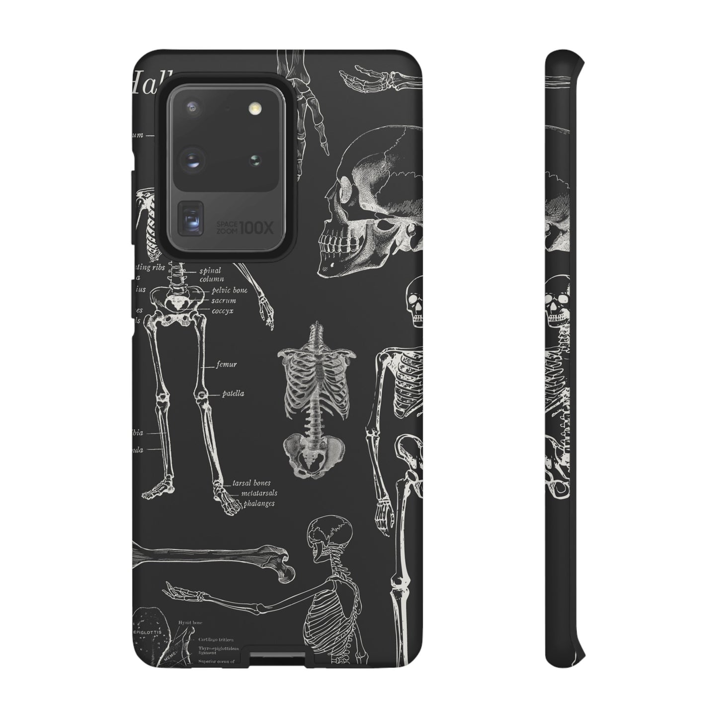 Skeleton Wallpaper Phone Case | iPhone 15 Plus/ Pro, 14, 13, 12| Google Pixel 7, Pro, 5| Samsung Galaxy S23 All Major Phone Models