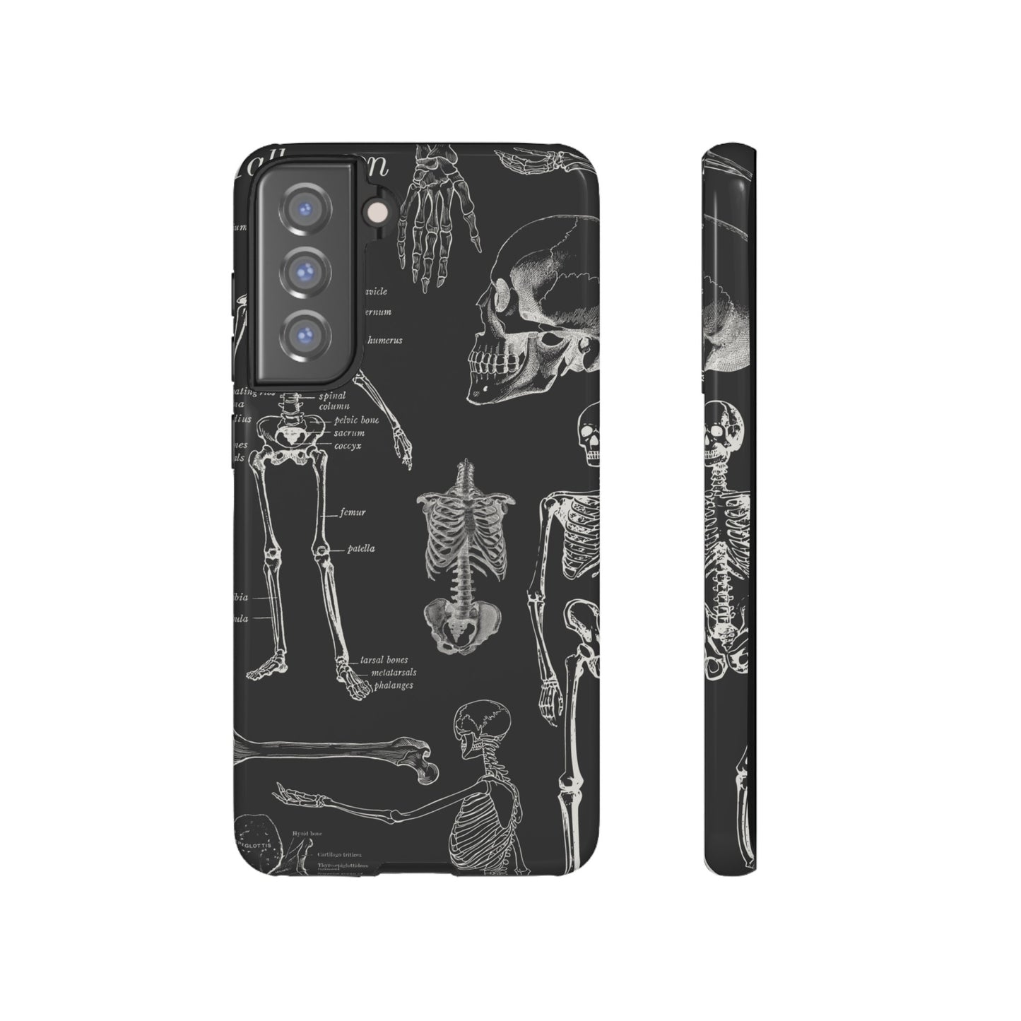 Skeleton Wallpaper Phone Case | iPhone 15 Plus/ Pro, 14, 13, 12| Google Pixel 7, Pro, 5| Samsung Galaxy S23 All Major Phone Models