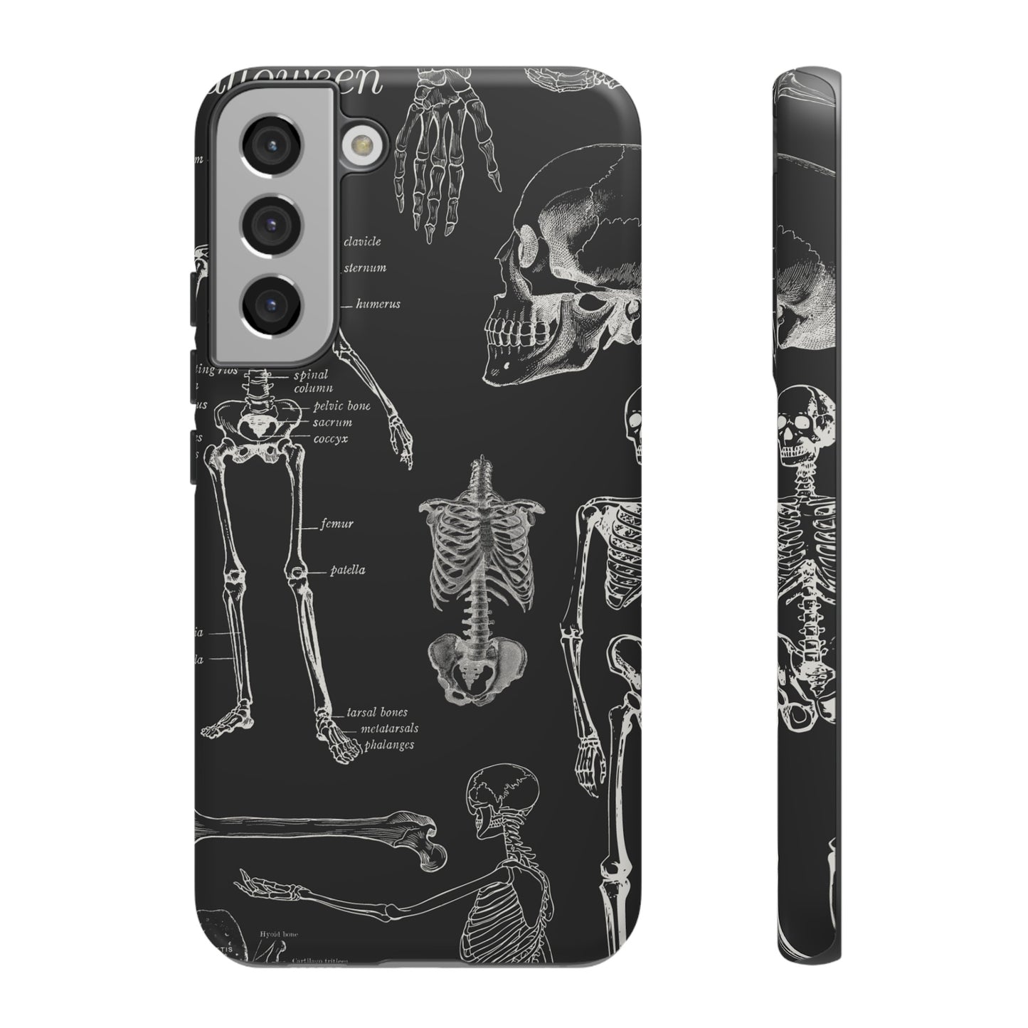 Skeleton Wallpaper Phone Case | iPhone 15 Plus/ Pro, 14, 13, 12| Google Pixel 7, Pro, 5| Samsung Galaxy S23 All Major Phone Models