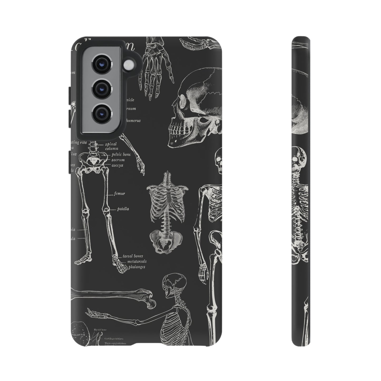 Skeleton Wallpaper Phone Case | iPhone 15 Plus/ Pro, 14, 13, 12| Google Pixel 7, Pro, 5| Samsung Galaxy S23 All Major Phone Models