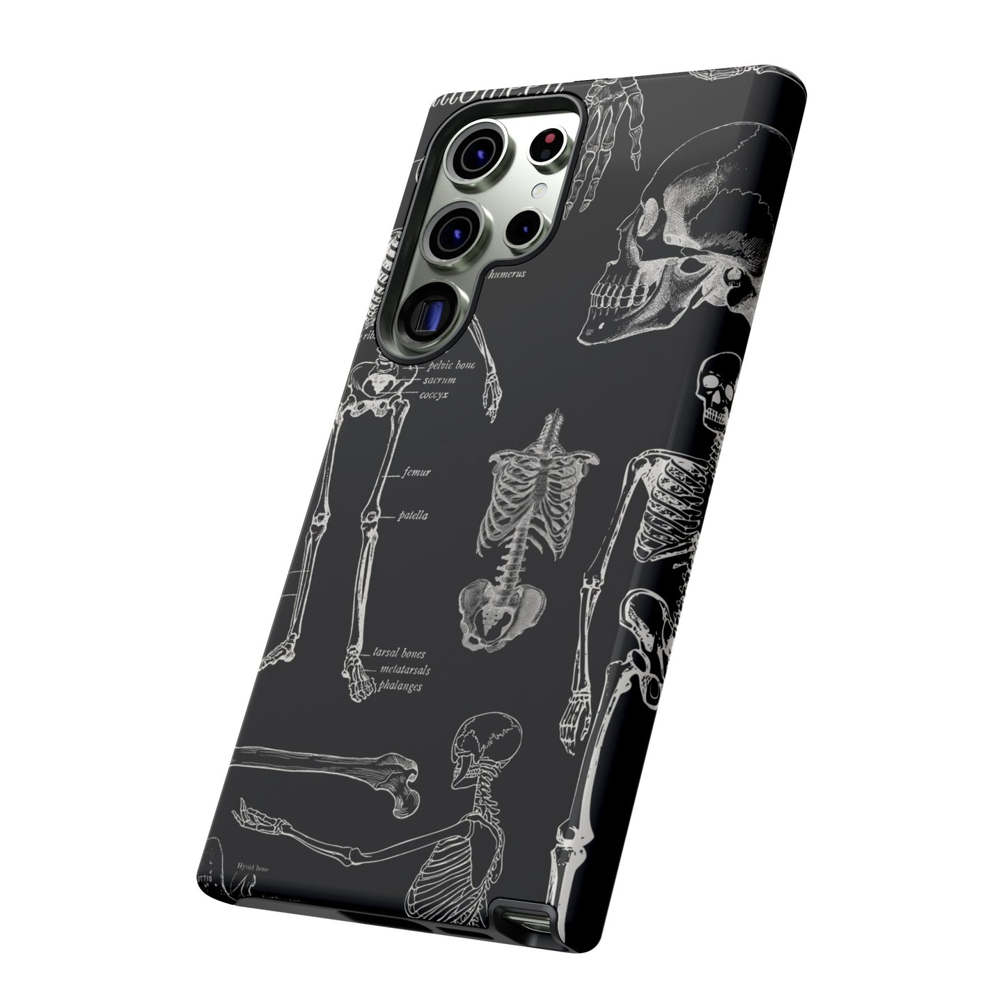 Skeleton Wallpaper Phone Case | iPhone 15 Plus/ Pro, 14, 13, 12| Google Pixel 7, Pro, 5| Samsung Galaxy S23 All Major Phone Models