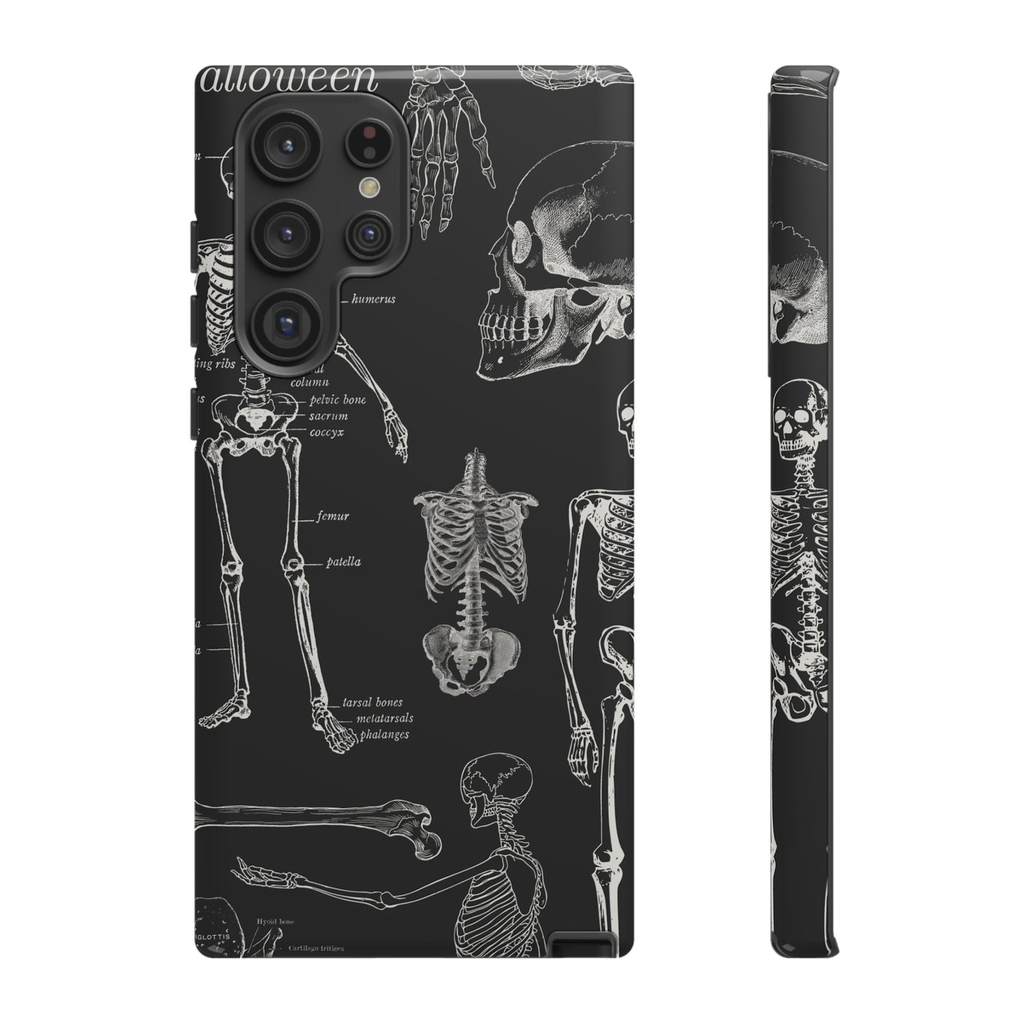 Skeleton Wallpaper Phone Case | iPhone 15 Plus/ Pro, 14, 13, 12| Google Pixel 7, Pro, 5| Samsung Galaxy S23 All Major Phone Models