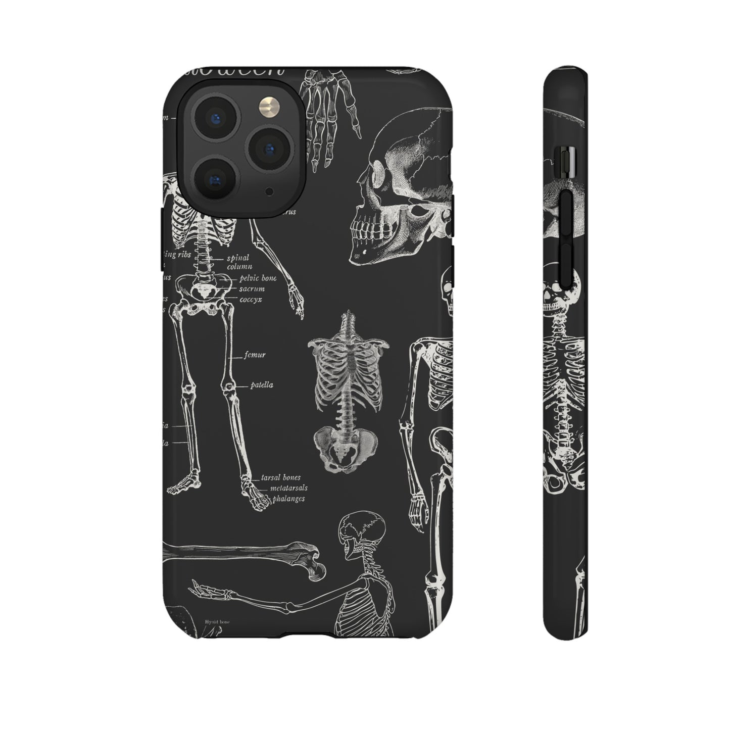 Skeleton Wallpaper Phone Case | iPhone 15 Plus/ Pro, 14, 13, 12| Google Pixel 7, Pro, 5| Samsung Galaxy S23 All Major Phone Models