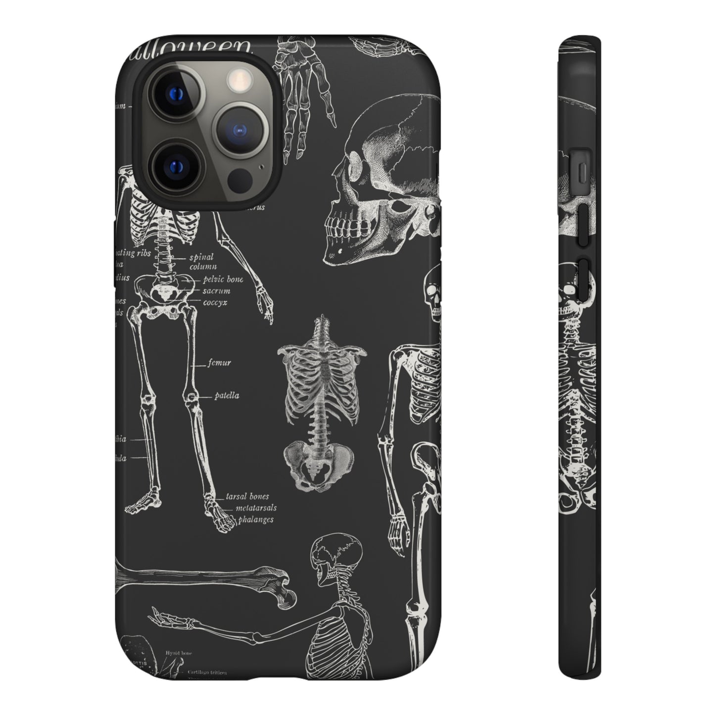 Skeleton Wallpaper Phone Case | iPhone 15 Plus/ Pro, 14, 13, 12| Google Pixel 7, Pro, 5| Samsung Galaxy S23 All Major Phone Models