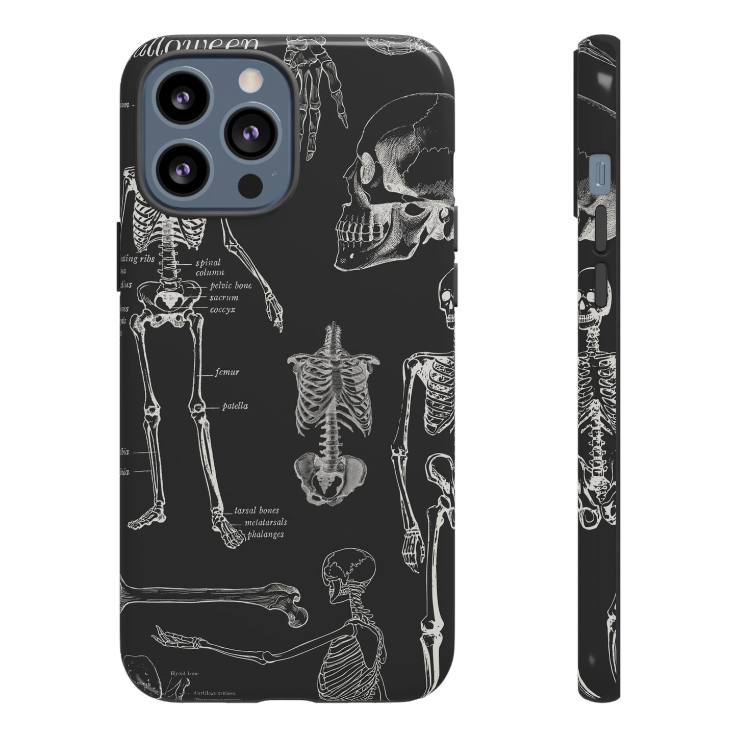 Skeleton Wallpaper Phone Case | iPhone 15 Plus/ Pro, 14, 13, 12| Google Pixel 7, Pro, 5| Samsung Galaxy S23 All Major Phone Models