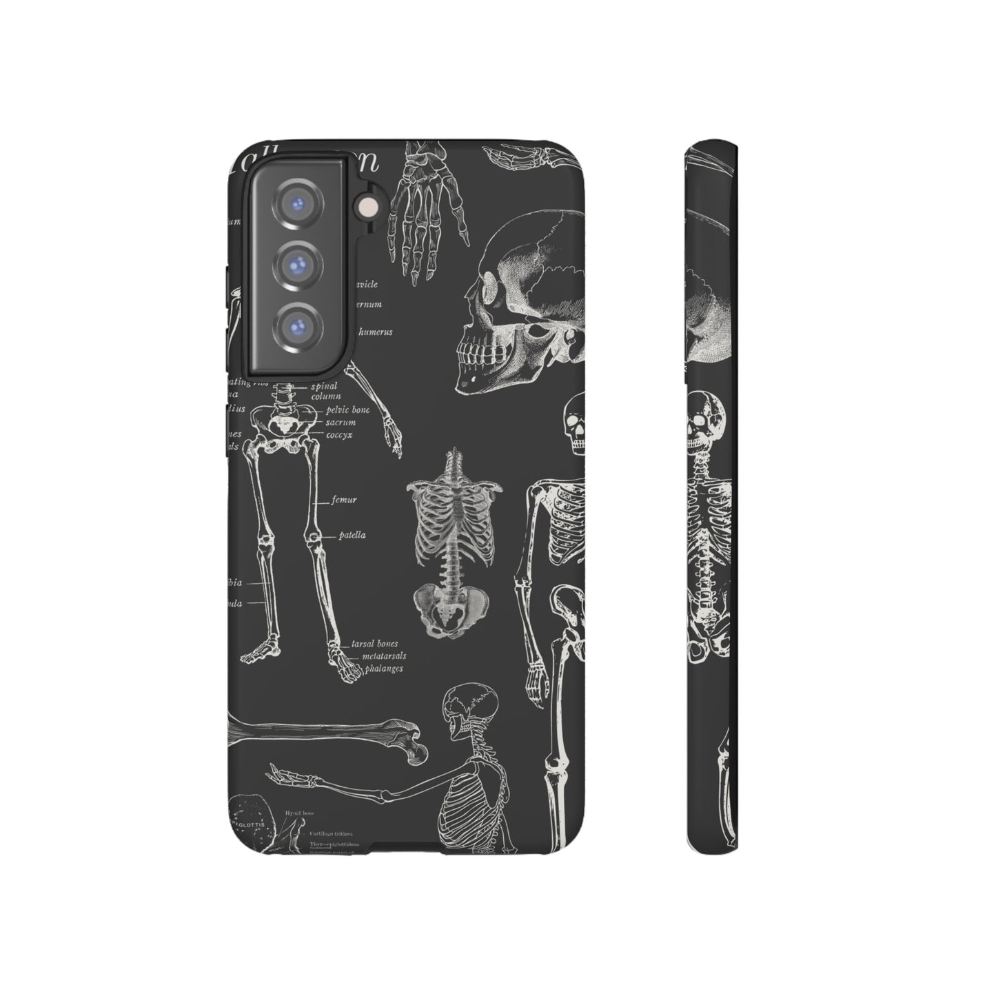 Skeleton Wallpaper Phone Case | iPhone 15 Plus/ Pro, 14, 13, 12| Google Pixel 7, Pro, 5| Samsung Galaxy S23 All Major Phone Models