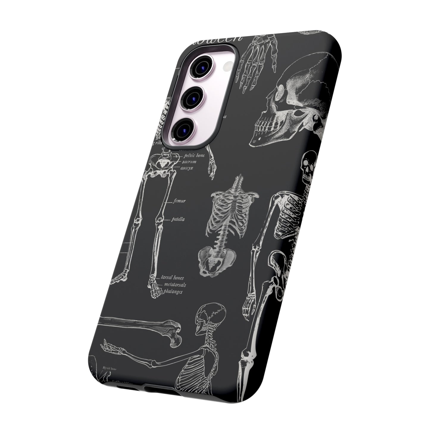 Skeleton Wallpaper Phone Case | iPhone 15 Plus/ Pro, 14, 13, 12| Google Pixel 7, Pro, 5| Samsung Galaxy S23 All Major Phone Models