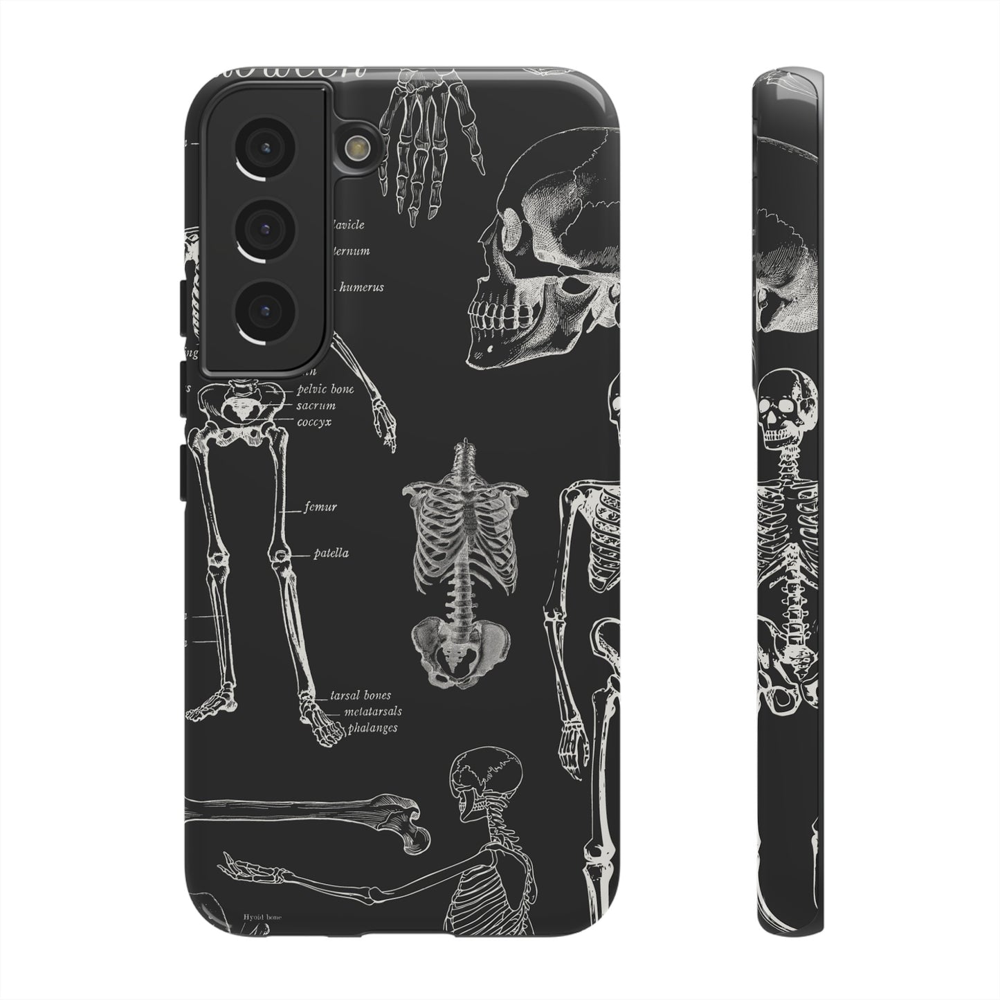 Skeleton Wallpaper Phone Case | iPhone 15 Plus/ Pro, 14, 13, 12| Google Pixel 7, Pro, 5| Samsung Galaxy S23 All Major Phone Models