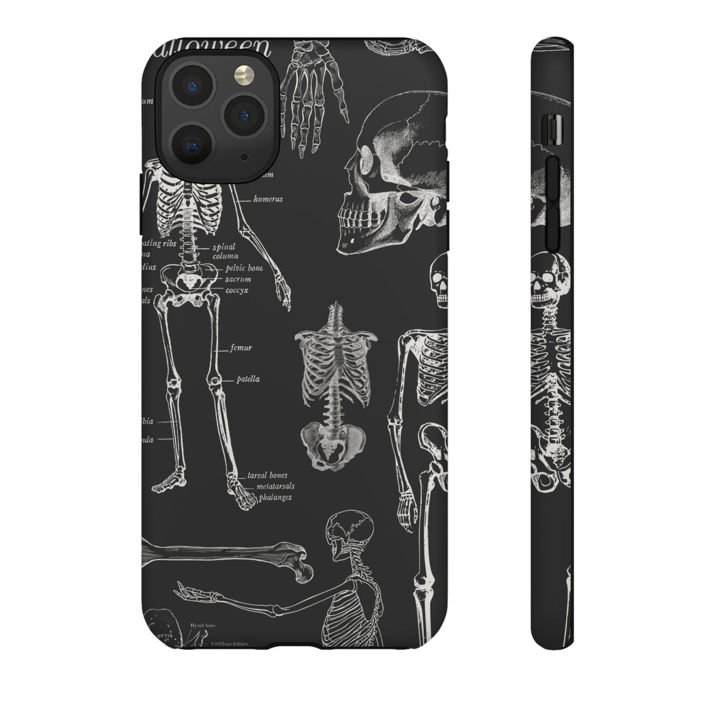 Skeleton Wallpaper Phone Case | iPhone 15 Plus/ Pro, 14, 13, 12| Google Pixel 7, Pro, 5| Samsung Galaxy S23 All Major Phone Models