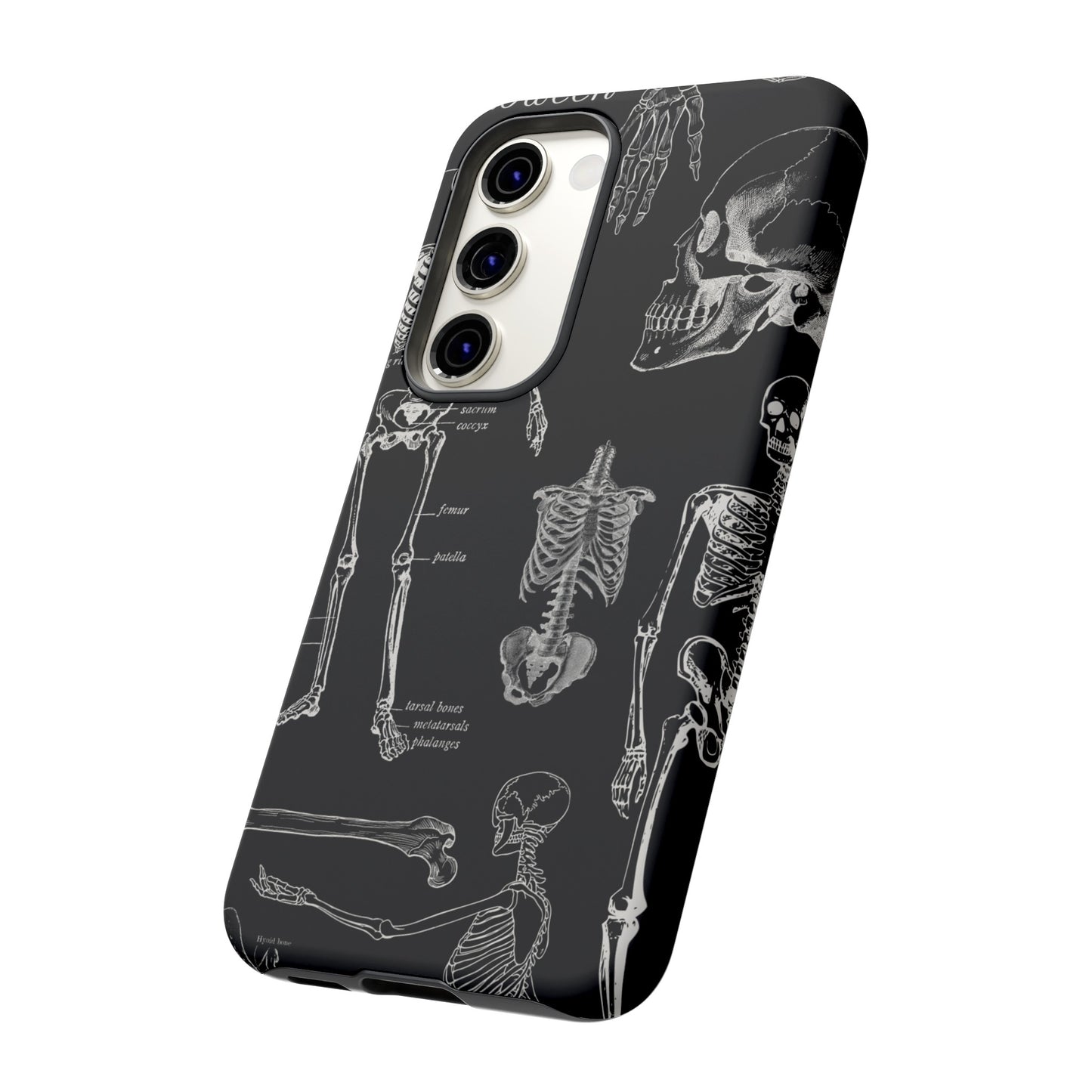 Skeleton Wallpaper Phone Case | iPhone 15 Plus/ Pro, 14, 13, 12| Google Pixel 7, Pro, 5| Samsung Galaxy S23 All Major Phone Models