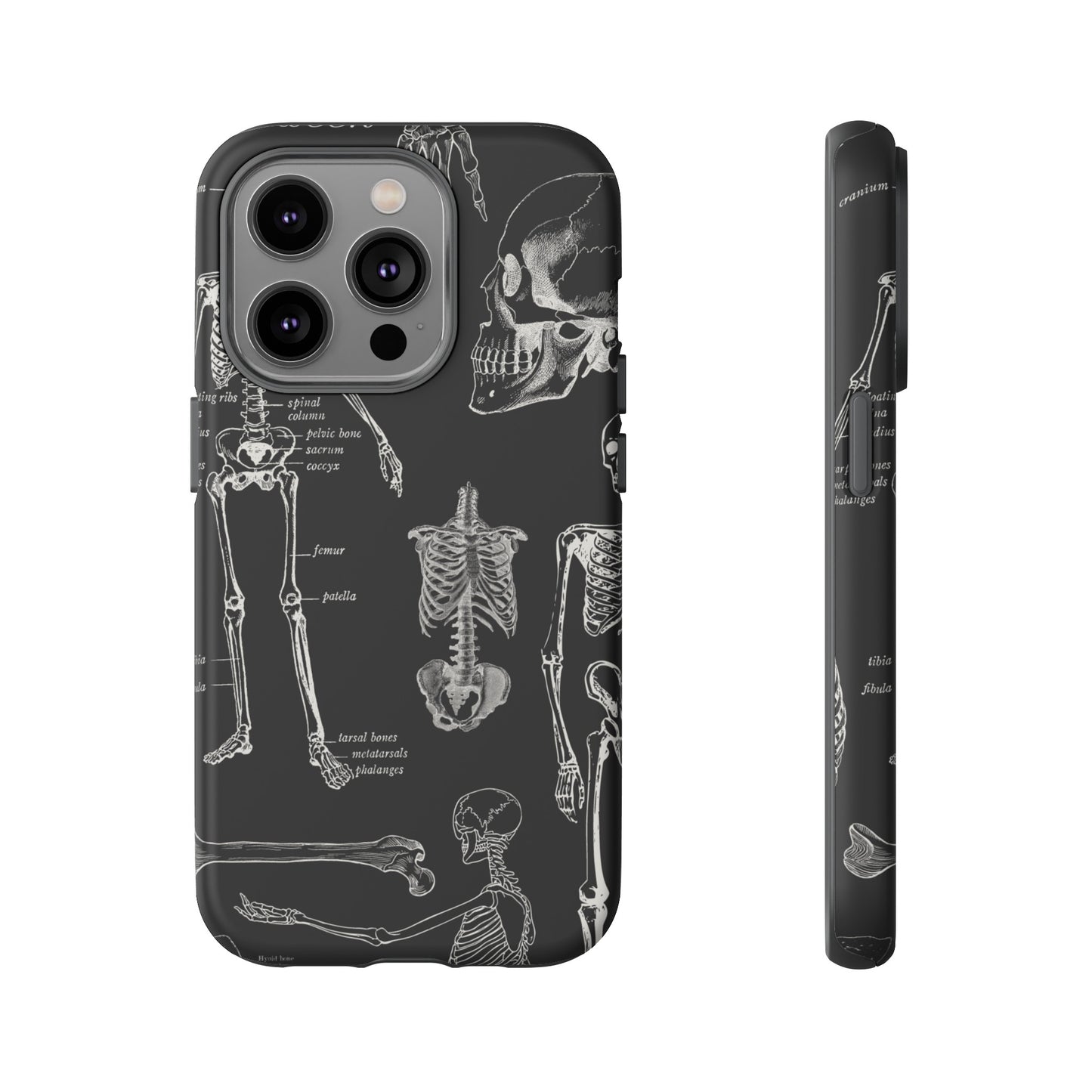 Skeleton Wallpaper Phone Case | iPhone 15 Plus/ Pro, 14, 13, 12| Google Pixel 7, Pro, 5| Samsung Galaxy S23 All Major Phone Models