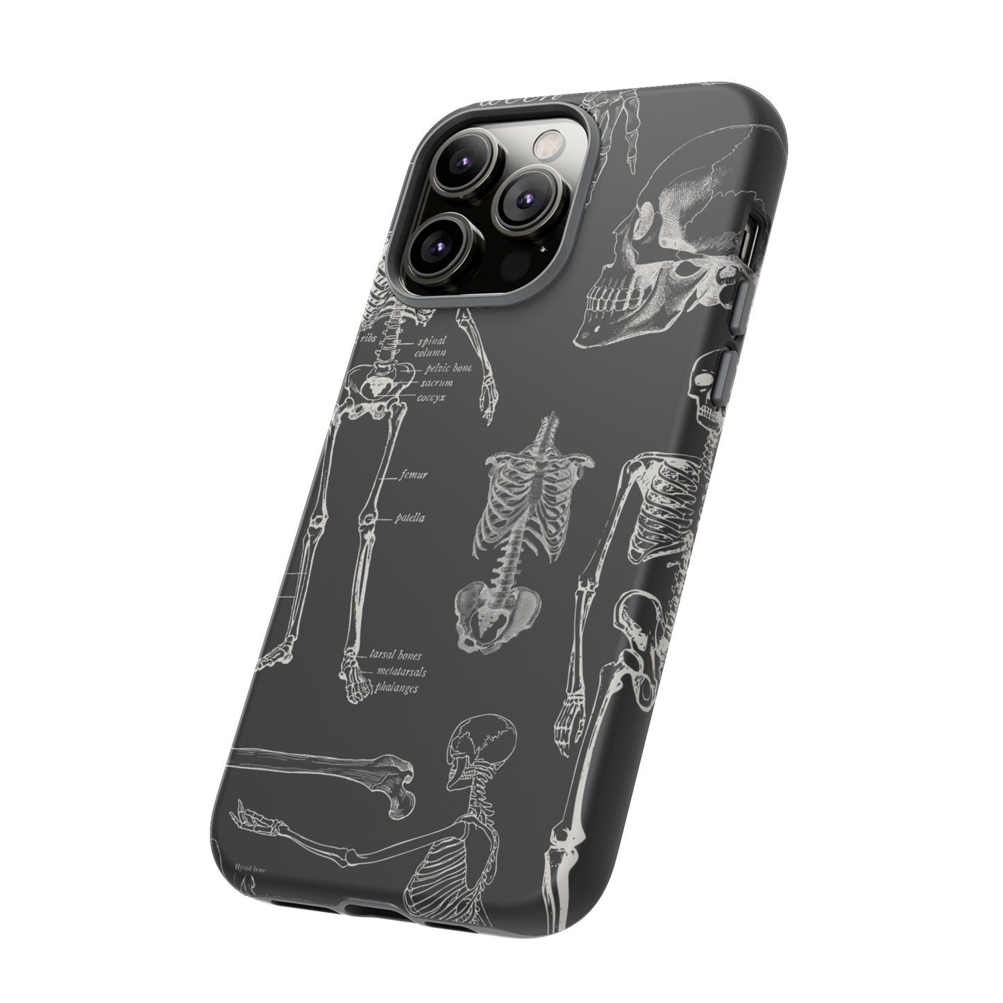 Skeleton Wallpaper Phone Case | iPhone 15 Plus/ Pro, 14, 13, 12| Google Pixel 7, Pro, 5| Samsung Galaxy S23 All Major Phone Models