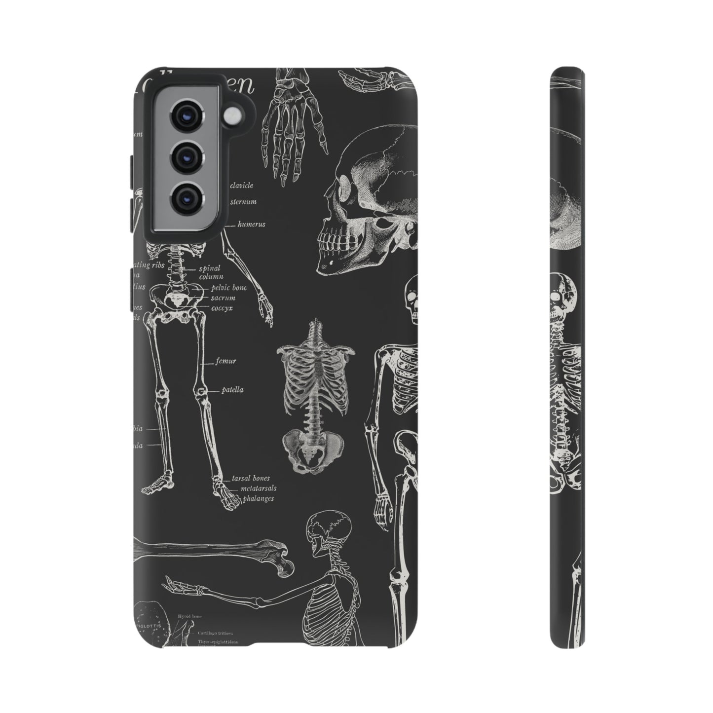 Skeleton Wallpaper Phone Case | iPhone 15 Plus/ Pro, 14, 13, 12| Google Pixel 7, Pro, 5| Samsung Galaxy S23 All Major Phone Models