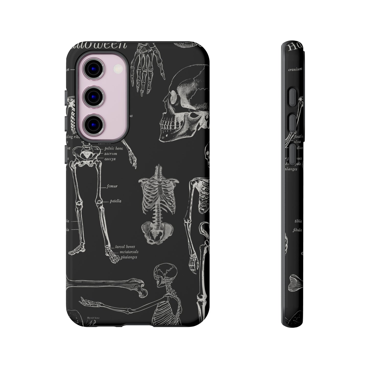 Skeleton Wallpaper Phone Case | iPhone 15 Plus/ Pro, 14, 13, 12| Google Pixel 7, Pro, 5| Samsung Galaxy S23 All Major Phone Models