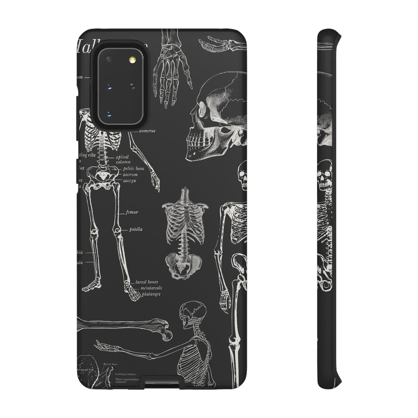 Skeleton Wallpaper Phone Case | iPhone 15 Plus/ Pro, 14, 13, 12| Google Pixel 7, Pro, 5| Samsung Galaxy S23 All Major Phone Models