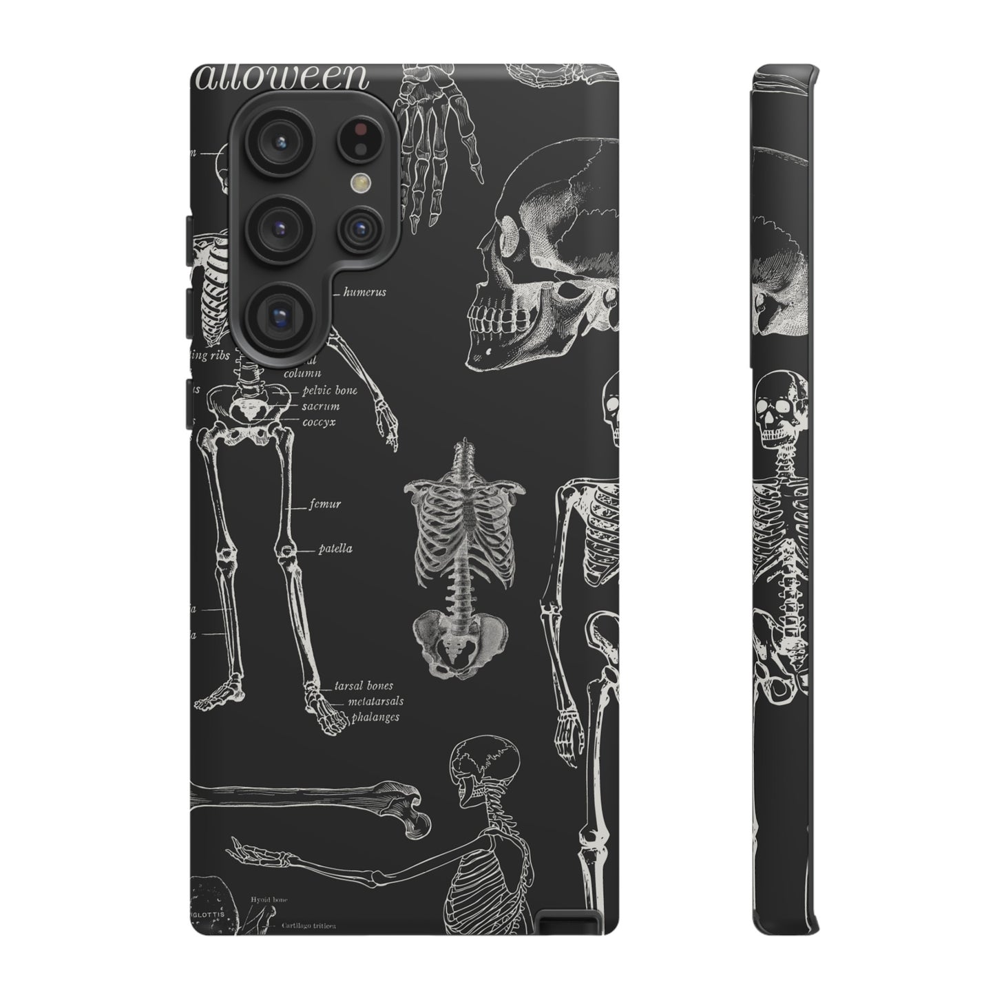 Skeleton Wallpaper Phone Case | iPhone 15 Plus/ Pro, 14, 13, 12| Google Pixel 7, Pro, 5| Samsung Galaxy S23 All Major Phone Models