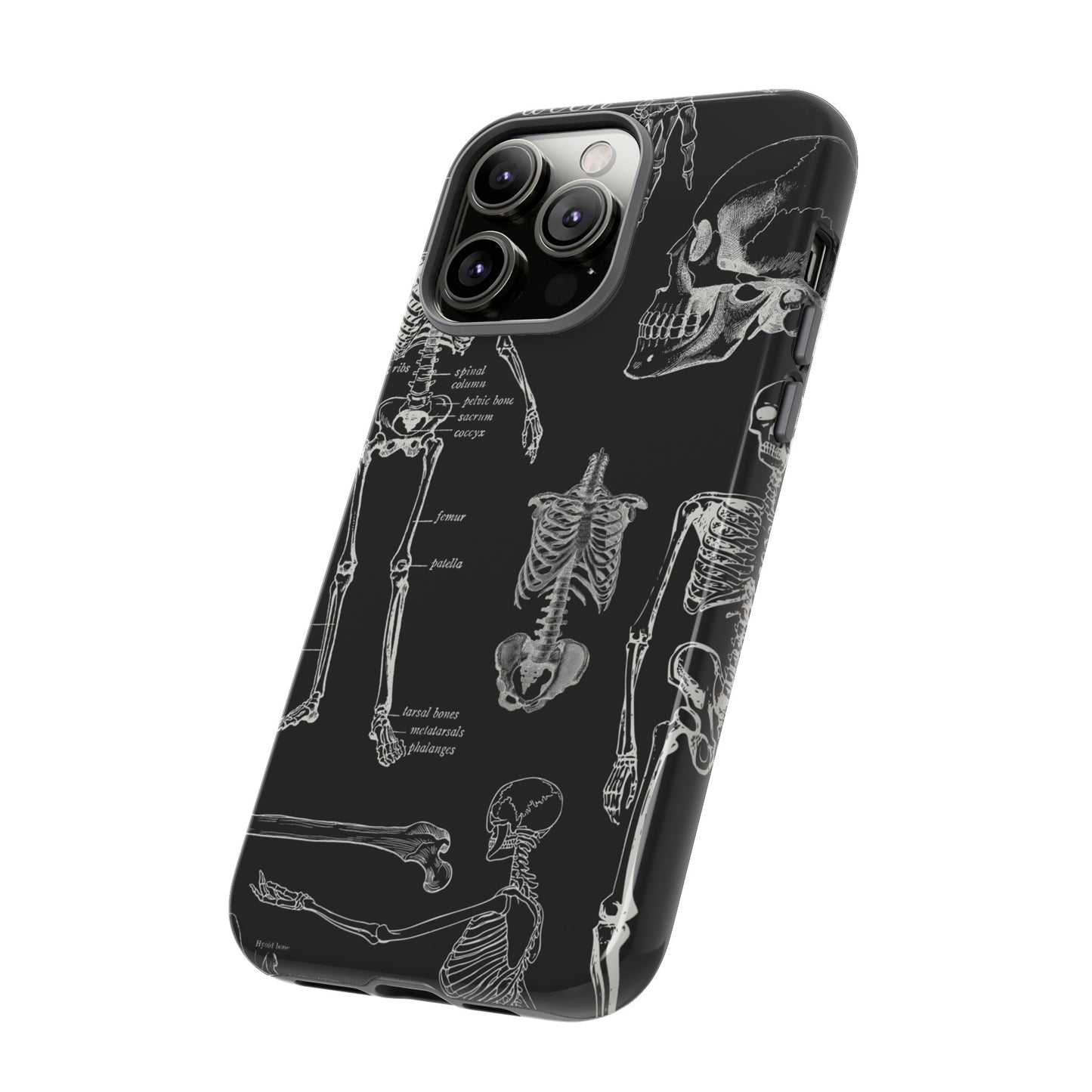 Skeleton Wallpaper Phone Case | iPhone 15 Plus/ Pro, 14, 13, 12| Google Pixel 7, Pro, 5| Samsung Galaxy S23 All Major Phone Models