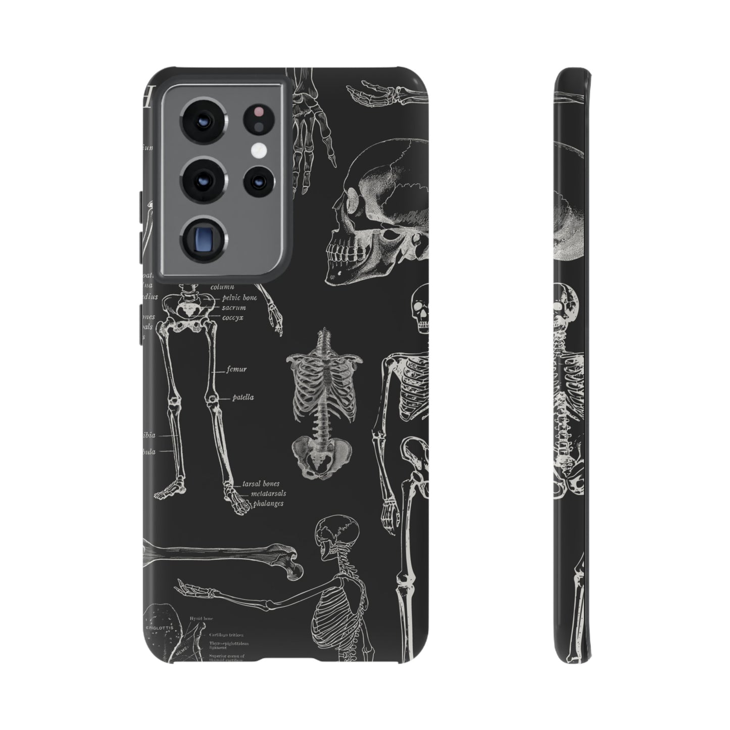 Skeleton Wallpaper Phone Case | iPhone 15 Plus/ Pro, 14, 13, 12| Google Pixel 7, Pro, 5| Samsung Galaxy S23 All Major Phone Models