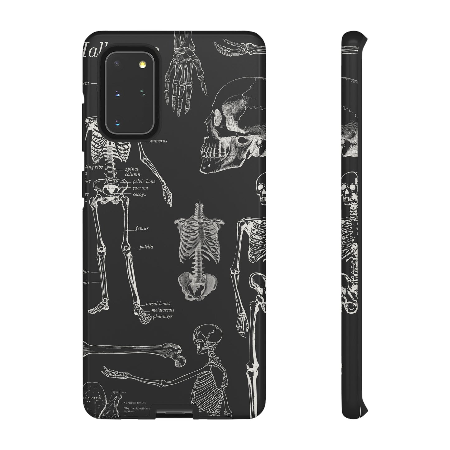 Skeleton Wallpaper Phone Case | iPhone 15 Plus/ Pro, 14, 13, 12| Google Pixel 7, Pro, 5| Samsung Galaxy S23 All Major Phone Models