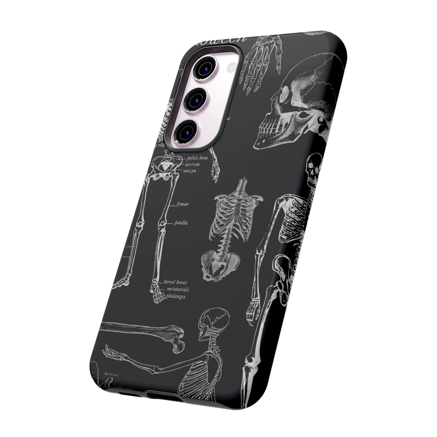 Skeleton Wallpaper Phone Case | iPhone 15 Plus/ Pro, 14, 13, 12| Google Pixel 7, Pro, 5| Samsung Galaxy S23 All Major Phone Models