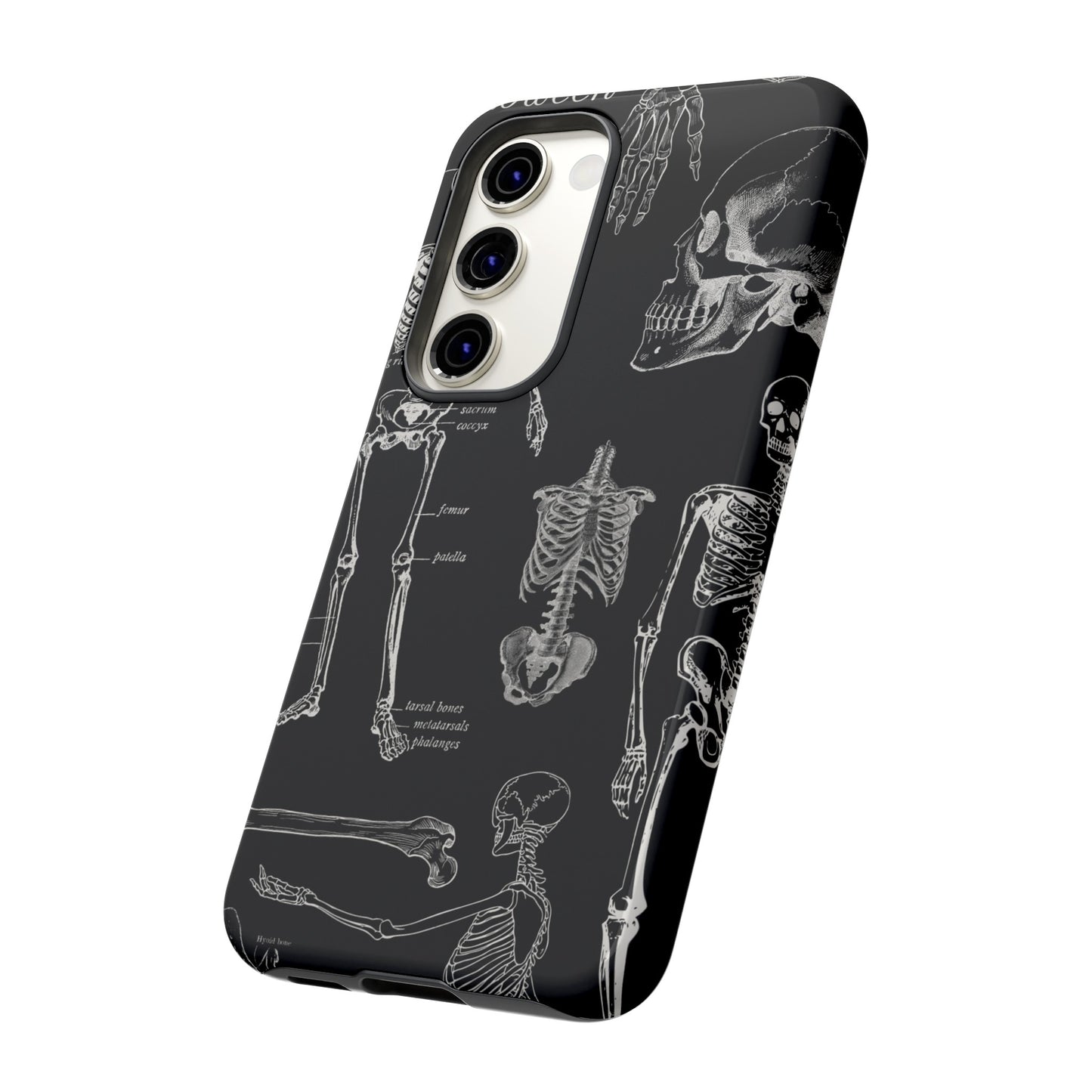 Skeleton Wallpaper Phone Case | iPhone 15 Plus/ Pro, 14, 13, 12| Google Pixel 7, Pro, 5| Samsung Galaxy S23 All Major Phone Models