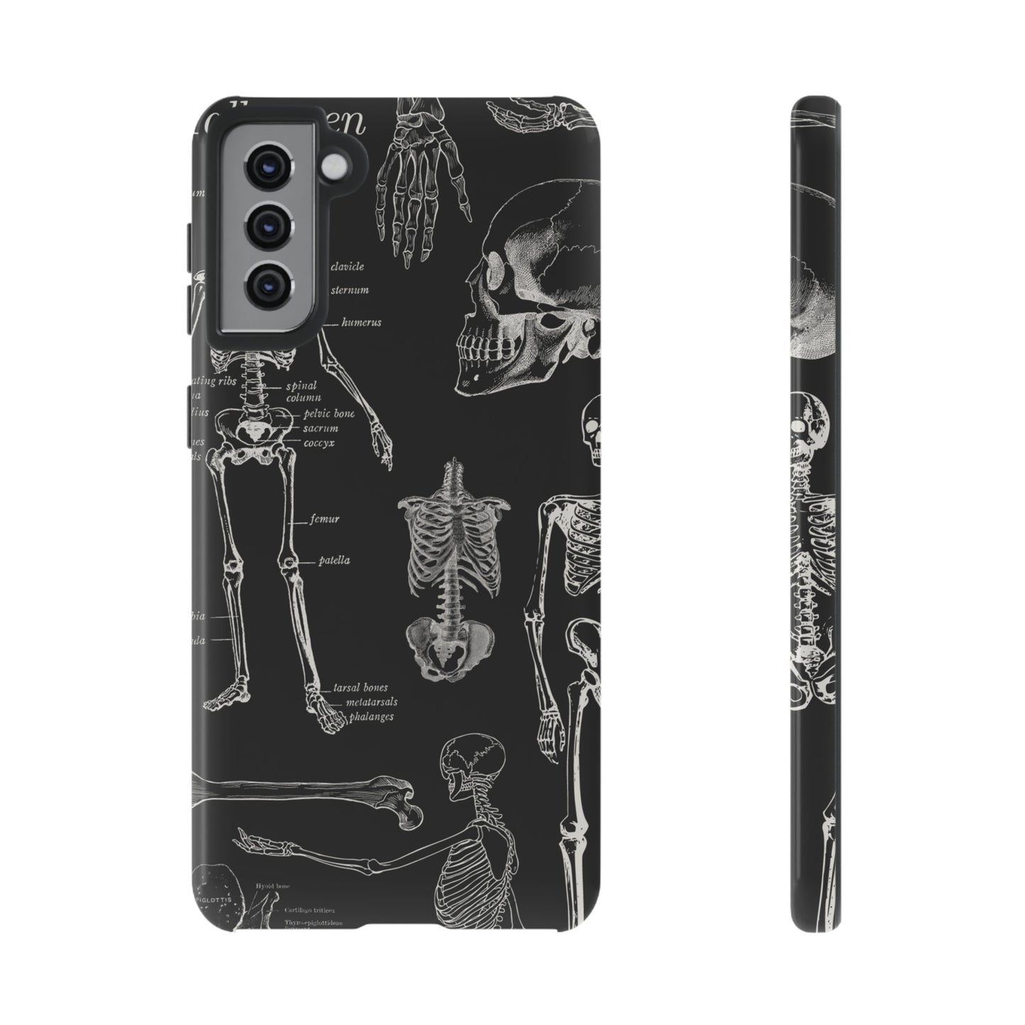 Skeleton Wallpaper Phone Case | iPhone 15 Plus/ Pro, 14, 13, 12| Google Pixel 7, Pro, 5| Samsung Galaxy S23 All Major Phone Models