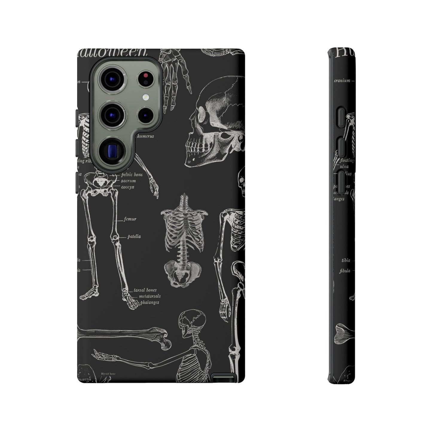 Skeleton Wallpaper Phone Case | iPhone 15 Plus/ Pro, 14, 13, 12| Google Pixel 7, Pro, 5| Samsung Galaxy S23 All Major Phone Models